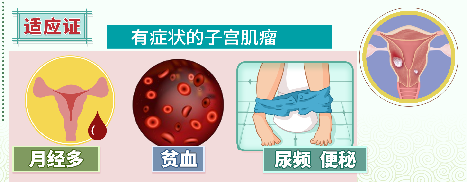 沈阳市经济技术开发区人民医院（沈阳市开发区医院）,子宫肌瘤