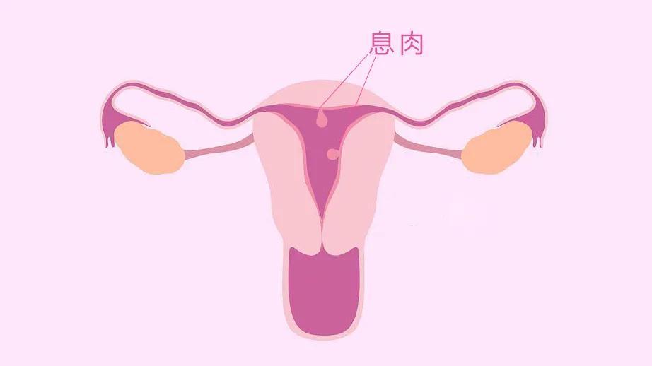 开发区医院官网（开发区医院）,子宫内膜异位症