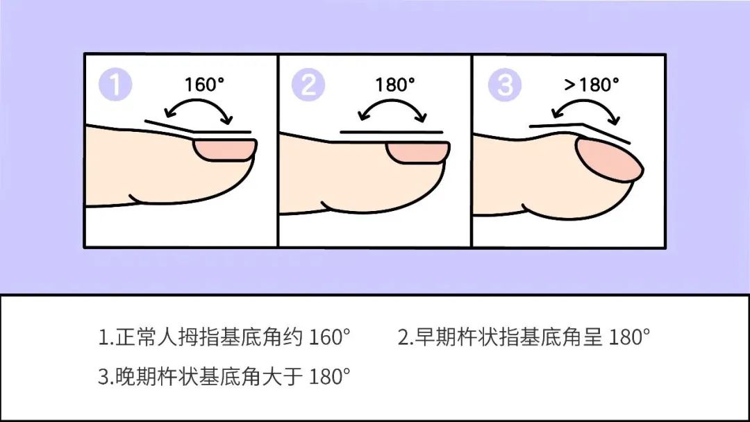 沈阳开发区医院官网（沈阳经济技术开发区）,肺部检查,肺部疾病
